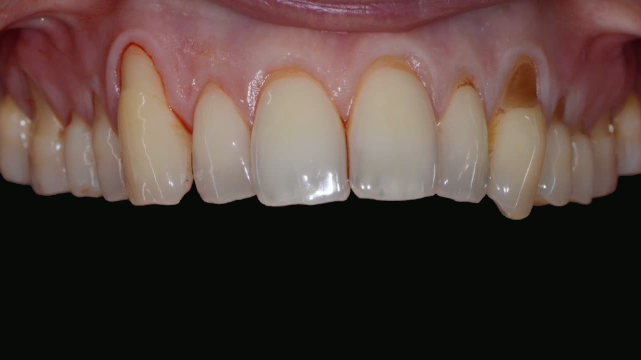 Przed